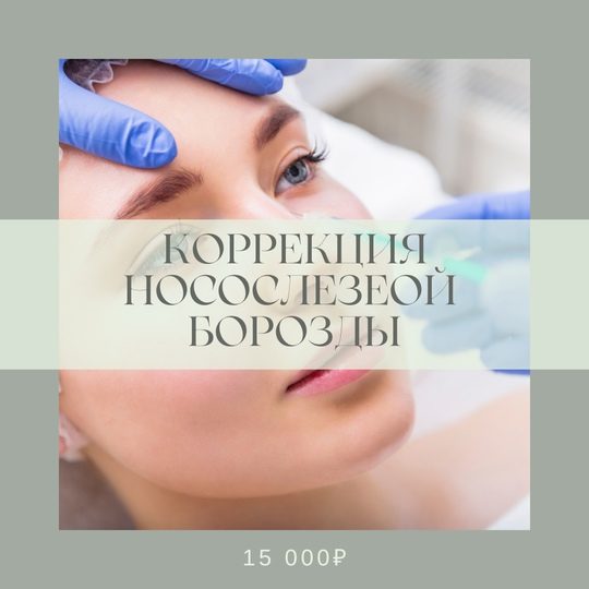 Коррекция носослезной борозды